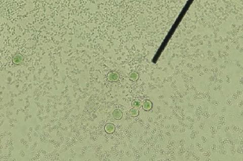 Candida yeast cells on non-nutrient agar surface 400X magnification, Scale bar = 10 μm