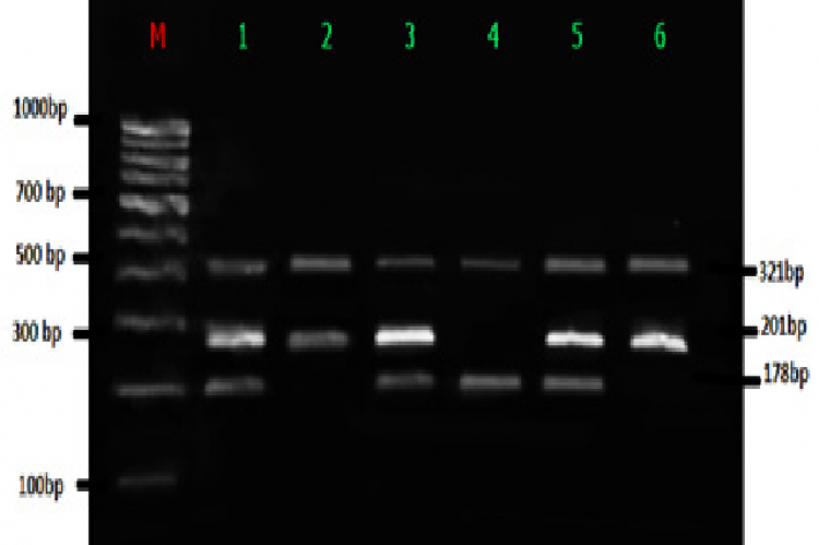 T-ARMS PCR Analysis of FTO gene. (M) - 100 bp Molecular marker; Lane1, 3, 6 (AT-321 bp, 210 bp, 178bp); Lane 2,5(TT-321bp, 178 bp); Lane 4 (AA-321 bp, 201bp)