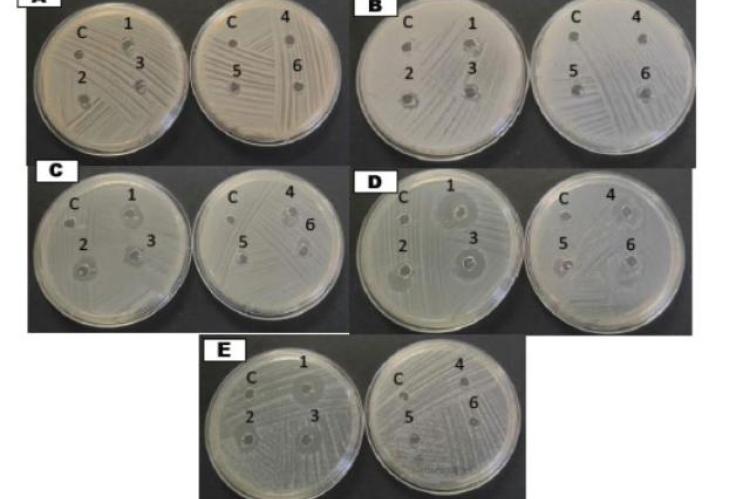 Minimum inhibitory concentration of of Myristica fragrans extract