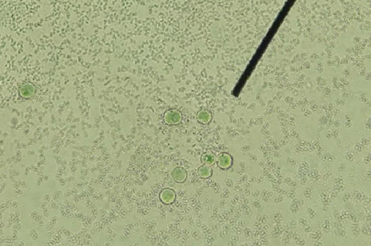 Candida yeast cells on non-nutrient agar surface 400X magnification, Scale bar = 10 μm