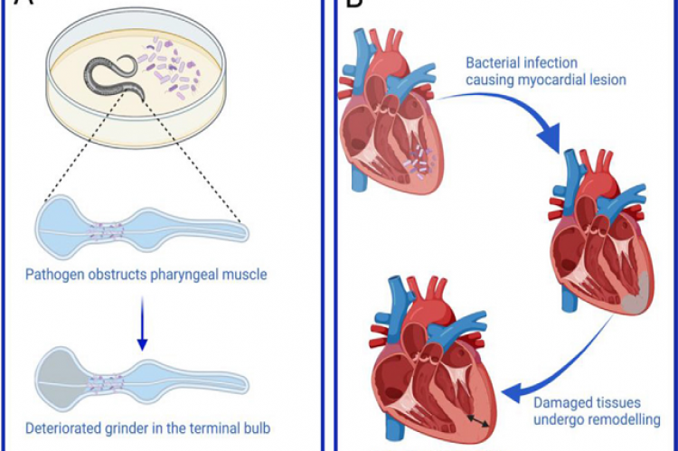 The bacterial infection leads to muscle