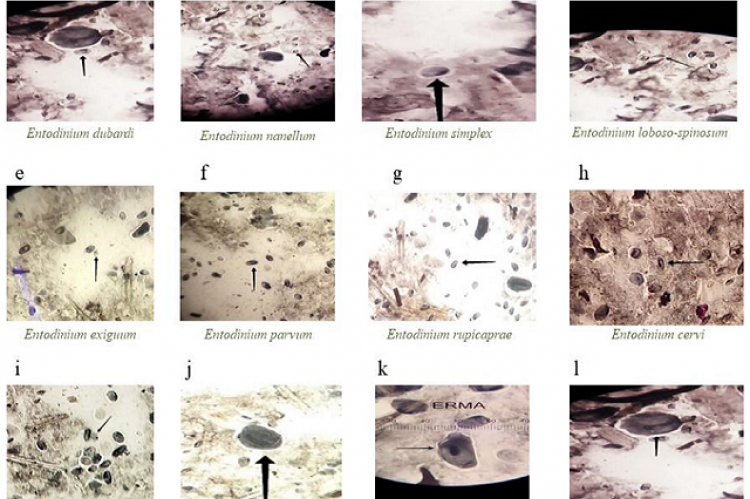 Light microscopic images of the identified ciliates at 10X magnification