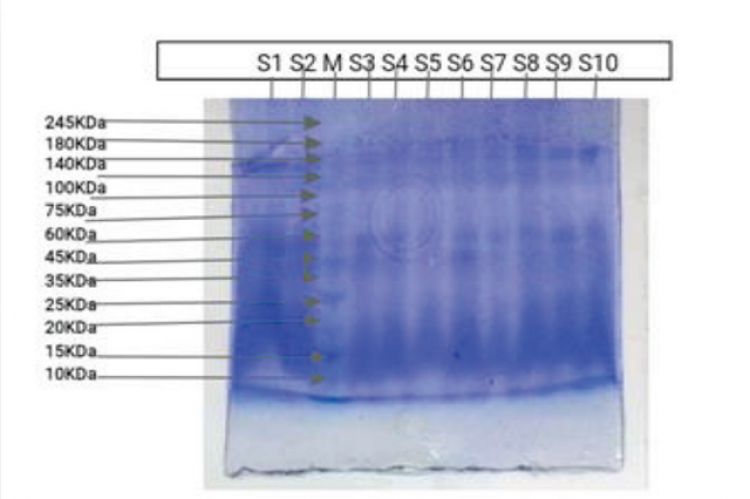 The electrophoretic banding pattern of Rice (Oryza sativa) accessions generated by SDS-PAGE