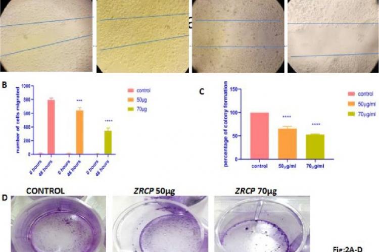 ZRCP inhibits cancer cell proliferation in vitro A) Wound healing assay (MCF-7 cells), B) Graph representing number of cells migrating