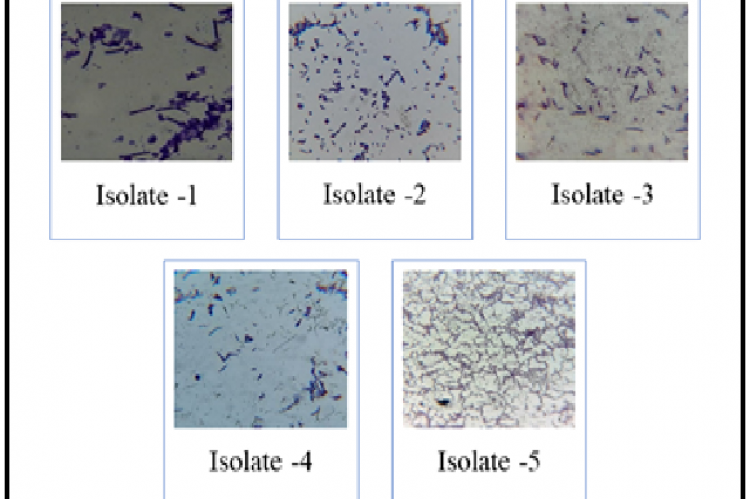 Microscopic view of the isolated strains using compound microscope