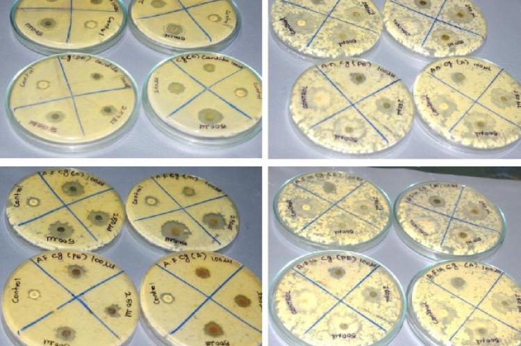 To present in the antifungal activity in plants to given positive and negative results for the disc diffusion assay