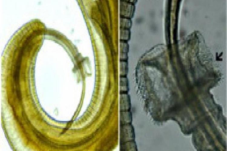 Males of Trichuris sp. recovered from gut of wild rat, Rattus rattus