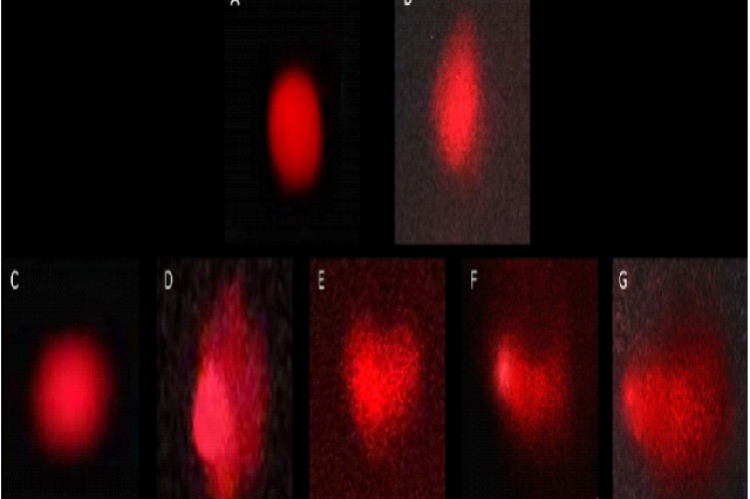 Extent of DNA damage assessed by comet assay in brain cells