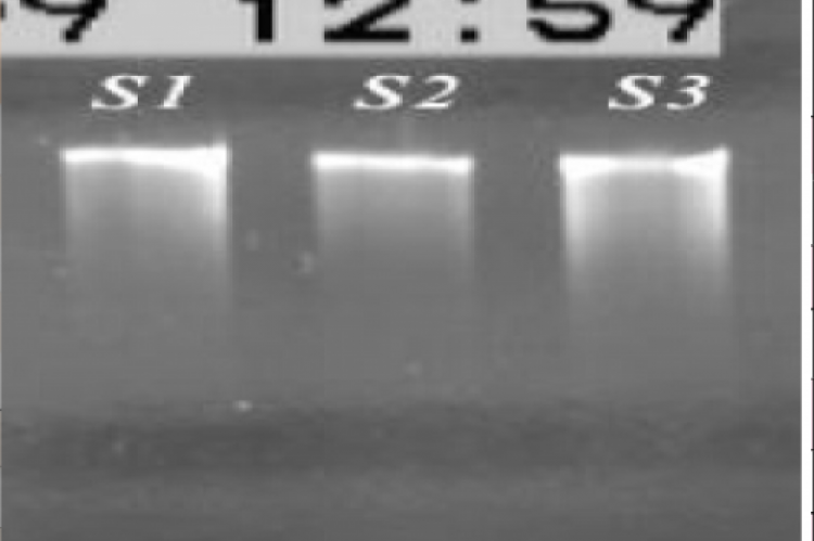 Quality assessment of blood DNA extract using electrophoresis 