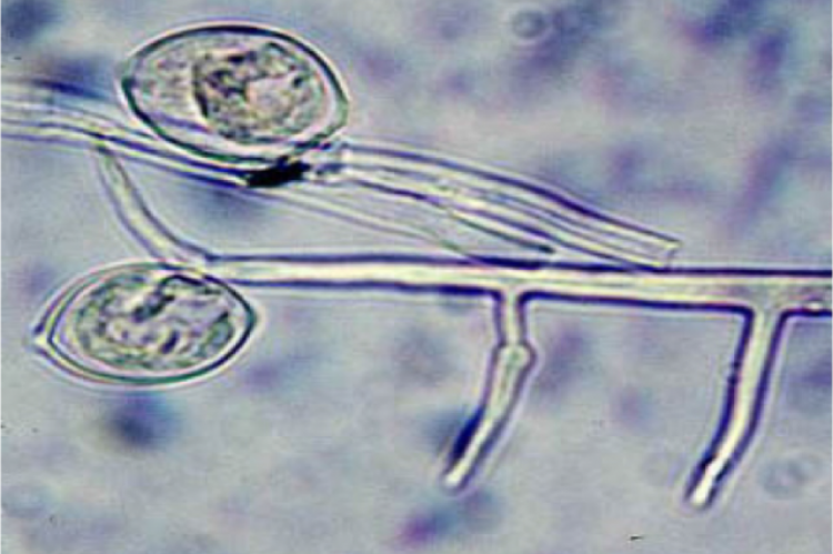 Sporangium of Phythium 