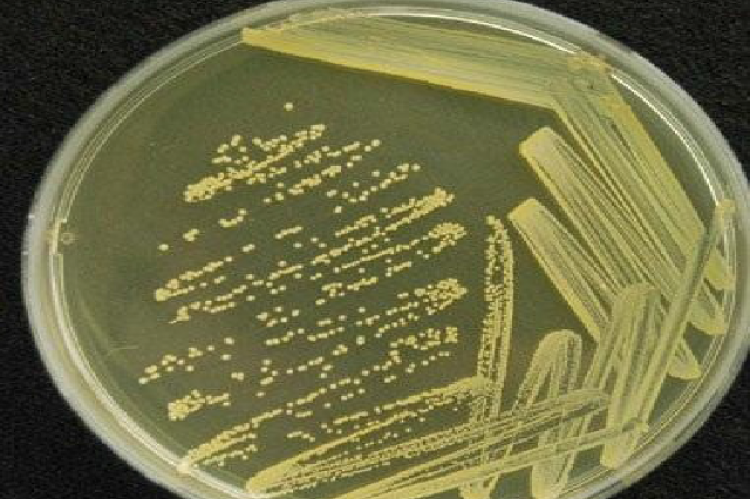 Streak plate of the Isolate 