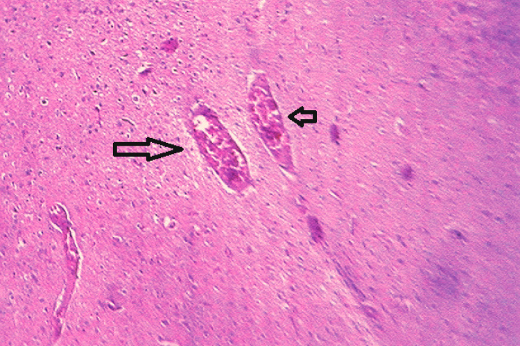 Sections of Cerebral Cortex region, stained with Hematoxylin and Eosin-30th day of experimentation (40 X).