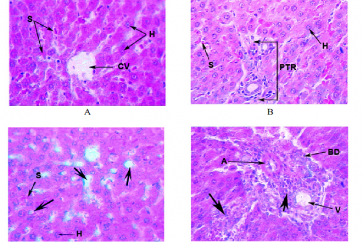 Effect of Short and Long Term Intake of Traditional Aphrodisiac Cantharis Q on Liver of Male Albino Rat