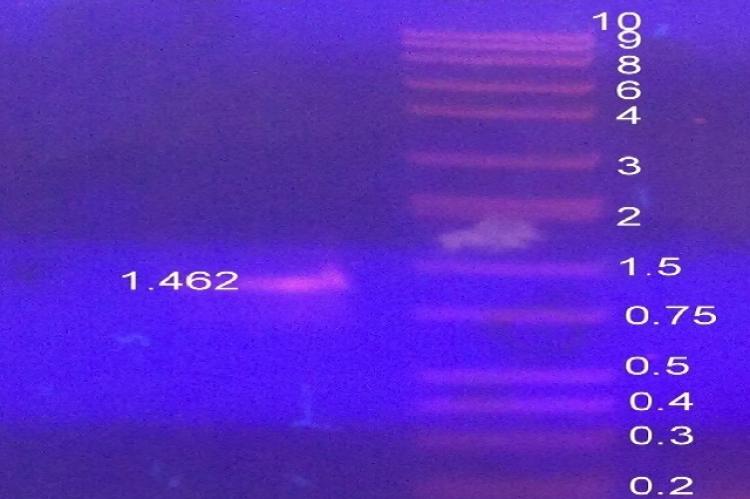 PCR product of 1467 bp of calB gene was observed on 1% Agarose gel