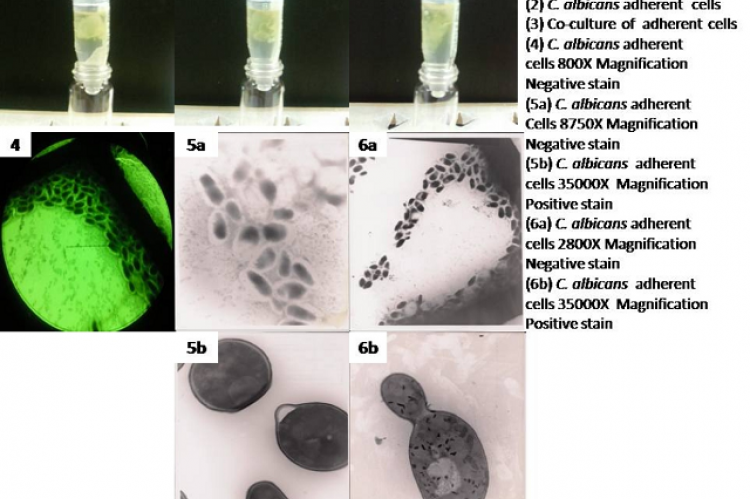 C. albicans and E. coli Adherent Cells 