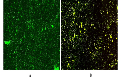 Fluorescence microscopic images of biofilm inhibition. (A) Untreated P. aeruginosa culture showing green flurescence. (B) Yellow flurescence from P. aeruginosa culture treated with methanolic extract of C. zanthorrhiza.