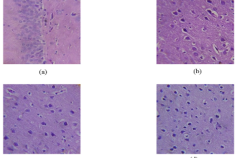 Histopathological examination of the brain (a) control male (b) control female (c) high dose male (d) high dose female.