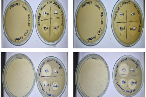 Antimicrobial activity of Metapenaeus dobsoni. (a) Anti-microbial activity of Metapenaeus dobsoni (Escherichia coli), (b) Anti-microbial activity of Metapenaeus dobsoni (Staphylococcus aureus).