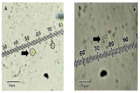Micrographs of isolated Naegleria sp. (A) cyst and (B) trophozoite. Photos courtesy of G. Milanez, Far Eastern Univeristy Manila