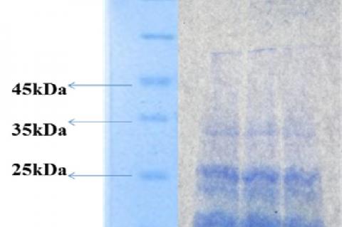 Electrophoretic profile of pumpkin seed protein