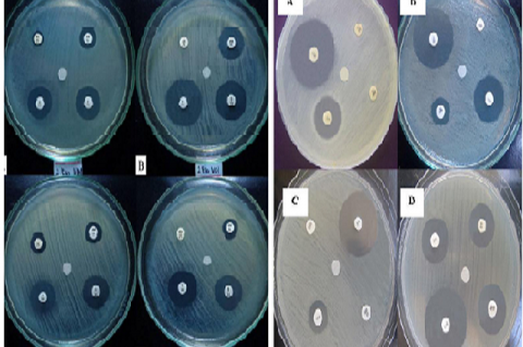 Occurrence and Antibiotic Sensitivity of Escherichia coli and Salmonella spp. in Retail Chicken Meat at Selected Markets in Valencia City, Bukidnon, Philippines