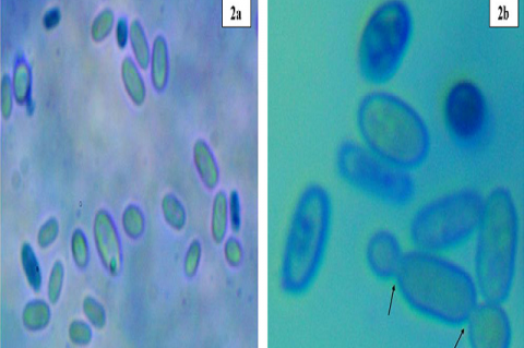 Microscopic appearance of R. mucilaginosa under