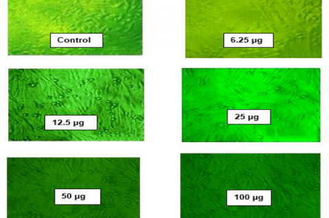 MTT assays Revealed that the Doxycycline SLNs Decreased the Percent Viability of all the Cells in Different Concentrations.