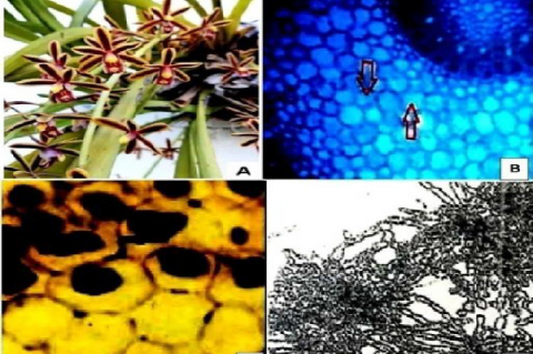 A- Plant Cymbidium pendulum, B- TS of roots showing behavior of fungal infection showing digested fungal hyphe, C- peloton formation