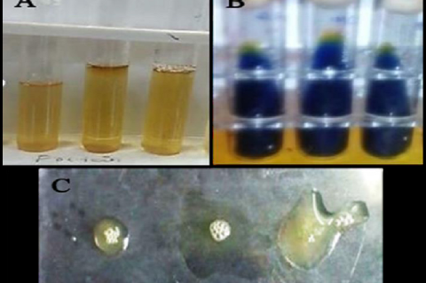 Image showing the various biochemical tests. Voges-Proskauer test (A), Citrate utilization test (B) and Coagulase test (C).