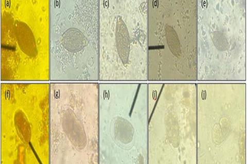 Stained ova of Soil Transmitted-Helminths (a) to (e) Demonstrated the egg of Trichuris suis and (f) to (j) demonstrated the egg of Strongyloides ransomi. (a) Lugol’s iodine. (b) Ethanol extract of Mangosteen. (c) Distilled water extract of Mangosteen. (d) Ethanol extract of Dragon fruit. (e) Distilled water extract of dragon fruit. (g) Ethanol extract of Mangosteen. (h) Distilled water extract of Mangosteen. (i) Ethanol extract of Dragon fruit. (j) Distilled water extract of dragon fruit.