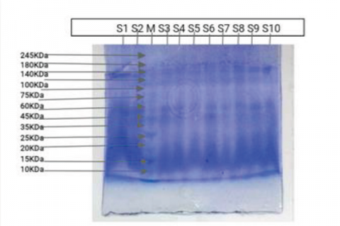 The electrophoretic banding pattern of Rice (Oryza sativa) accessions generated by SDS-PAGE