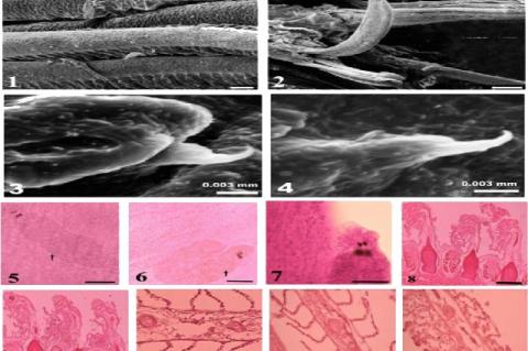 Scanning Electron Micrograph