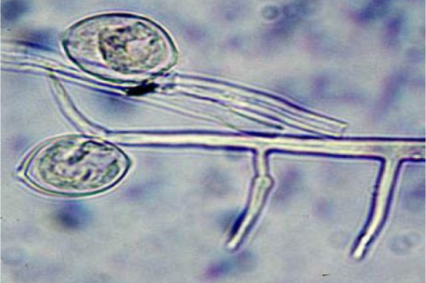 Sporangium of Phythium 