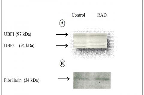 Immunoprecipitation of the human transcription factor hUBF and fibrillarin. 