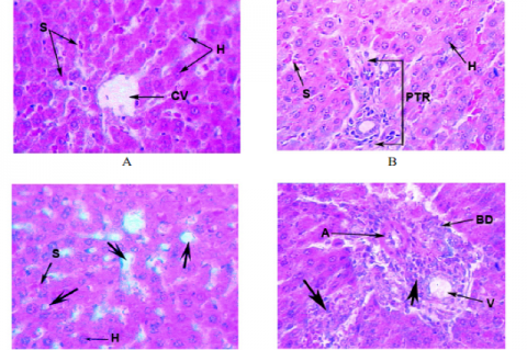 Effect of Short and Long Term Intake of Traditional Aphrodisiac Cantharis Q on Liver of Male Albino Rat