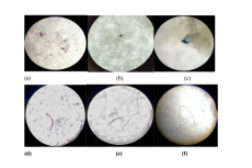 Microscopical photographs of Microplastics