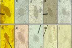 Stained ova of Soil Transmitted-Helminths (a) to (e) Demonstrated the egg of Trichuris suis and (f) to (j) demonstrated the egg of Strongyloides ransomi. (a) Lugol’s iodine. (b) Ethanol extract of Mangosteen. (c) Distilled water extract of Mangosteen. (d) Ethanol extract of Dragon fruit. (e) Distilled water extract of dragon fruit. (g) Ethanol extract of Mangosteen. (h) Distilled water extract of Mangosteen. (i) Ethanol extract of Dragon fruit. (j) Distilled water extract of dragon fruit.